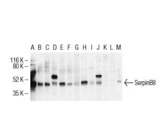 SerpinB8 Antibody (PI-8) - Western Blotting - Image 38343 