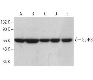 SerRS Antibody (C-2) - Western Blotting - Image 370797 