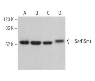 SerRSmt Antibody (C-11) - Western Blotting - Image 372855 