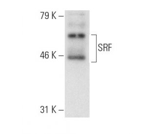 serum reponse factor /SRF Antibody (A-11) - Western Blotting - Image 8679 