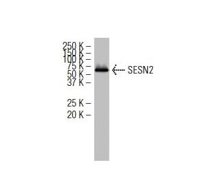 SESN2 Antibody (41-K) - Western Blotting - Image 34608 