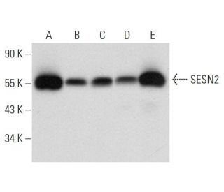 SESN2 Antibody (F-1) - Western Blotting - Image 314487