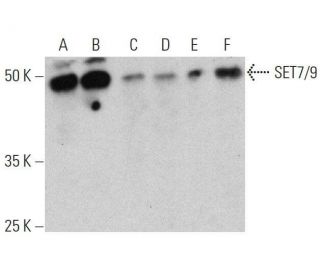 SET7/9 Antibody (C-11) - Western Blotting - Image 359534 