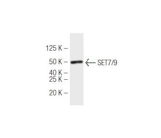 SET7/9 Antibody (s4E5) - Western Blotting - Image 47917