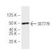 SET7/9 Antibody (s4E5) - Western Blotting - Image 47917
