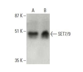 SET7/9 Antibody (C-11) - Western Blotting - Image 396652