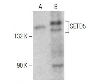 SETD5 Antibody (D-12) - Western Blotting - Image 356238