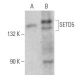 SETD5 Antibody (D-12) - Western Blotting - Image 356238