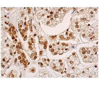 immunohistochemistry image from recommended SF-1 (A-1) monoclonal antibody replacement. Image 343941
