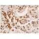 immunohistochemistry image from recommended SF-1 (A-1) monoclonal antibody replacement. Image 343941