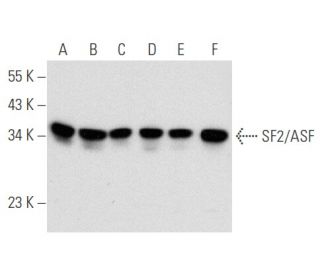 western blotting image from recommended SF2/ASF (96) monoclonal antibody replacement. Image 354787
