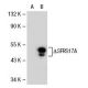 SFRS17A Antibody (FE-06) - Western Blotting - Image 31161