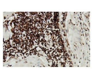 SGK Antibody (84-O) - Immunohistochemistry - Image 53899 