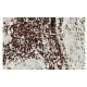 SGK Antibody (84-O) - Immunohistochemistry - Image 53899 