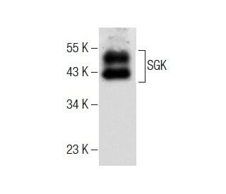 western blotting image from recommended SGK (G-4) monoclonal antibody replacement. Image 283824