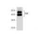 western blotting image from recommended SGK (G-4) monoclonal antibody replacement. Image 283824