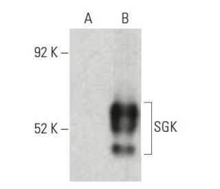 SGK Antibody (G-4) - Western Blotting - Image 397544