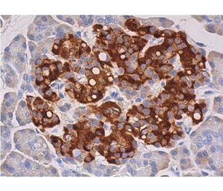 SGK Antibody (H-4) - Immunohistochemistry - Image 357538 