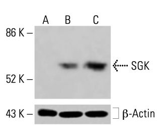 SGK Antibody (G-4) - Western Blotting - Image 414953 