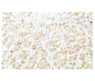 SgK223 Antibody (O67) - Immunohistochemistry - Image 53991