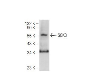 SGK3 Antibody (C-6) - Western Blotting - Image 109643 