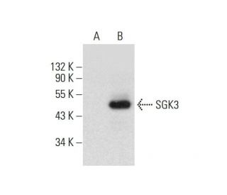 SGK3 Antibody (C-6) - Western Blotting - Image 131440 