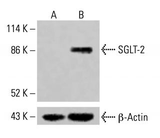 SGLT-2 Antibody (D-6) - Western Blotting - Image 415242