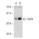 SGTA Antibody (6A4) - Western Blotting - Image 141385 