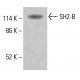 SH2-B Antibody (E-8) - Western Blotting - Image 415253