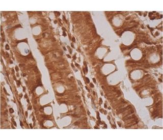 SH3D19 Antibody (G-6) - Immunohistochemistry - Image 293397 