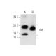 western blotting image from recommended Shh (E-1) monoclonal antibody replacement. Image 137799