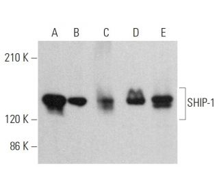 western blotting image from recommended SHIP-1 (P1C1) monoclonal antibody replacement. Image 379367