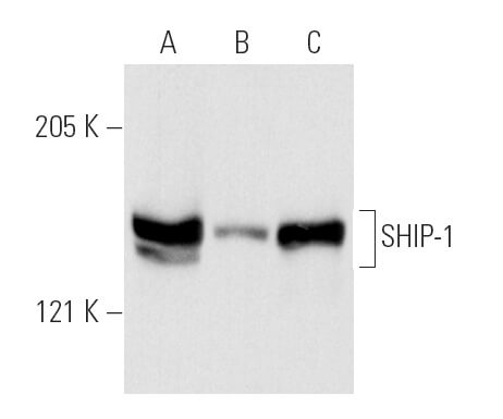 SHIP-1 Antibody (P1C1) | SCBT - Santa Cruz Biotechnology
