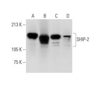 western blotting image from recommended SHIP-2 (E-2) monoclonal antibody replacement. Image 295684