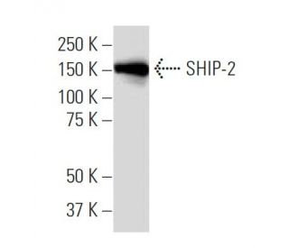 SHIP-2 Antibody (Z-16) - Western Blotting - Image 33763
