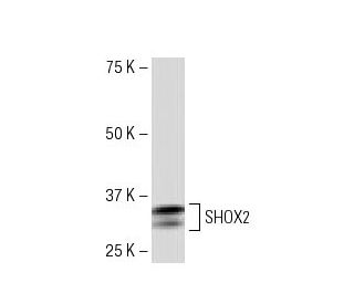 SHOX2 Antibody (JK-6E) - Western Blotting - Image 33604 