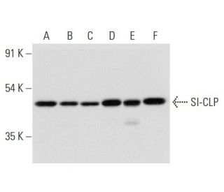 SI-CLP Antibody (A-1) - Western Blotting - Image 318037 