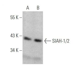 SIAH-1/2 Antibody (8G7H12) - Western Blotting - Image 372295