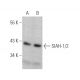 western blotting image from recommended SIAH-1/2 (8G7H12) monoclonal antibody replacement. Image 372295