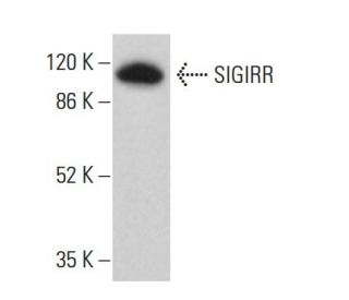 SIGIRR Antibody (G-8) - Western Blotting - Image 380562 