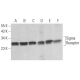 이 다클론 항체는 생산이 중단되었습니다. 권장 <a href="sigma-receptor-antibody-b-5">Sigma Receptor (B-5)</a> 단클론 항체(샘플 데이터 표시)를 참조하세요. western blotting image from recommended Sigma Receptor (B-5) monoclonal antibody replacement. Image 354440