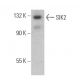 SIK2 Antibody (B-12) - Western Blotting - Image 359252 