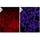siRNA Transfection Reagent: sc-29528. Immunofluorescence staining of methanol-fixed HeLa cells transfected with Cy3-labele