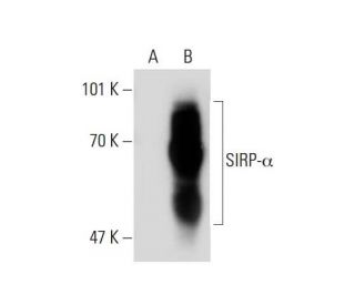 SIRP-&alpha;/&beta; Antibody (148) - Western Blotting - Image 138986 