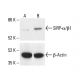 SIRP-α/β1 Antibody (A-1) - Western Blotting - Image 411955