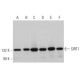 This polyclonal antibody has been discontinued. See our recommended <a href="sirt1-antibody-b-10">SIRT1 (B-10)</a> monoclonal antibody (sample data shown). western blotting image from recommended SIRT1 (B-10) monoclonal antibody replacement. Image 369313