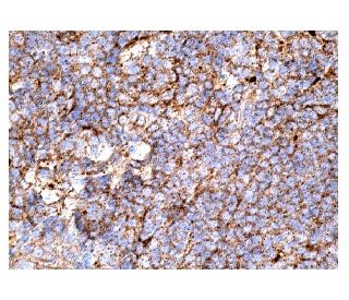 SIRT2 Antibody (A-5) - Immunohistochemistry - Image 156806 