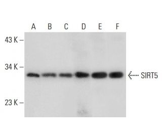 SIRT5 Antibody (G-2) - Western Blotting - Image 305943 