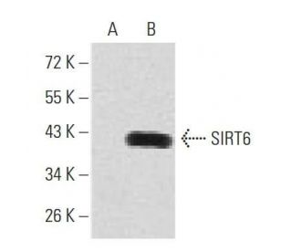 SIRT6 Antibody (2G1H1) - Western Blotting - Image 358291The Double Nickase Plasmid features a U6 promoter for sgRNA expression, a 20 nt targeting sequence, and a gRNA scaffold to guide Cas9n. It includes a CBh promoter for Cas9n (D10A) and puromycin resistance, GFP for transfection verification, and nuclear localization signals (NLS). The 2A peptide allows co-expression of Cas9n and Puro from a single promoter, enabling precise genome editing with reduced off-target effects.
