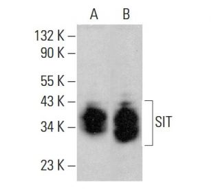 SIT Antibody (F-9) - Western Blotting - Image 384339 